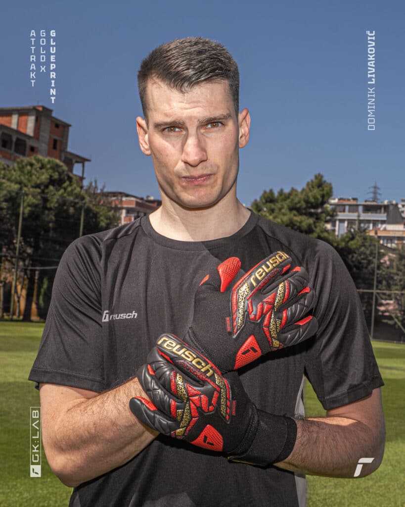 Gloves shown in the picture: 5570974